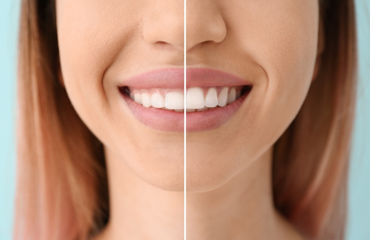 how-much-does-gum-recontouring-cost-l-ellicott-city-smiles